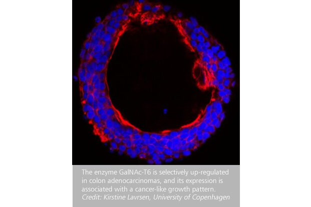 Cancer-defining-enzyme